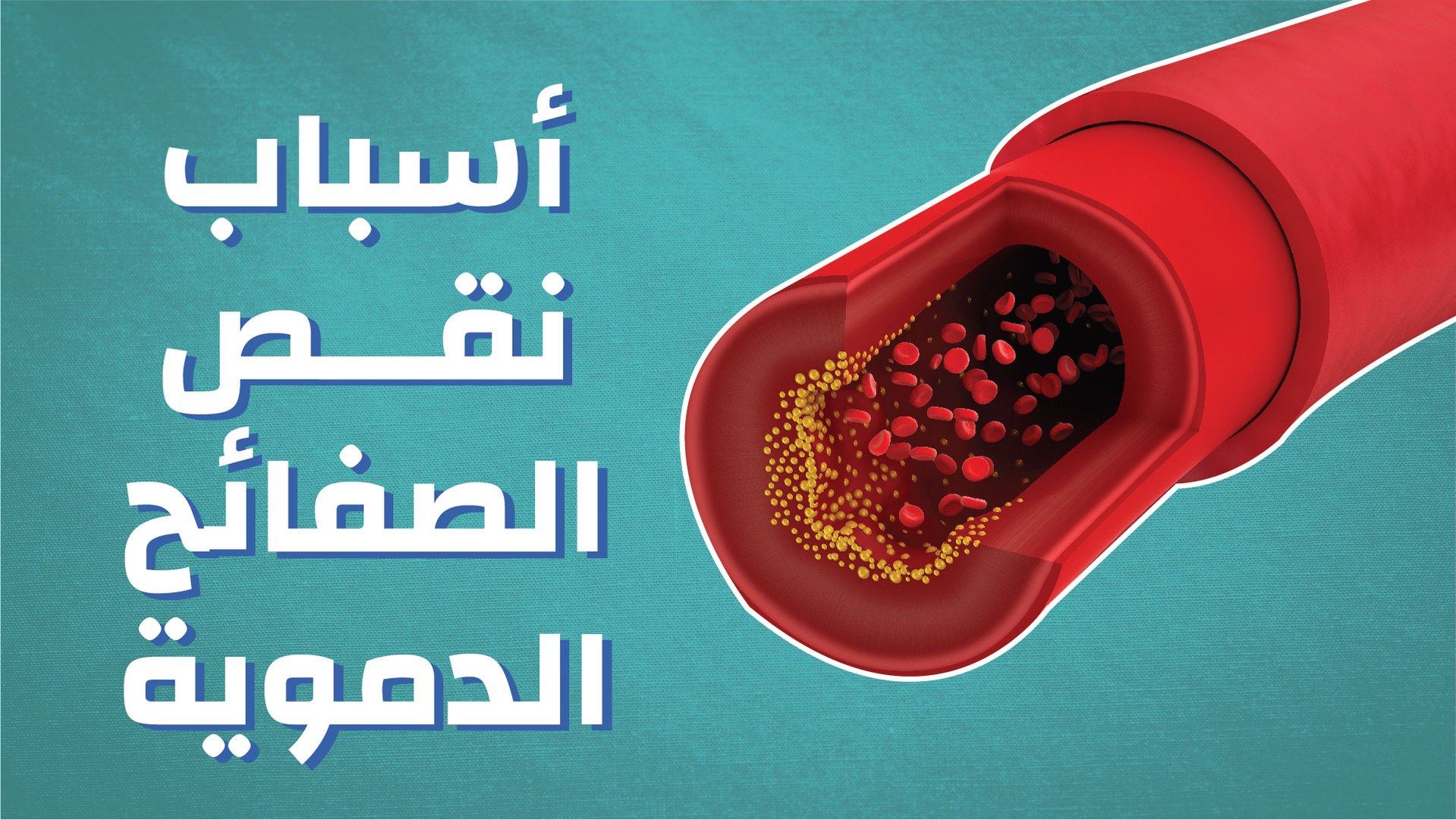 أطعمة تسبّب نقص بالصفائح الدموية وأطعمة للعلاج