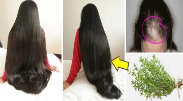 وصفة مجربة لانبات الشعر في مقدمة الراس