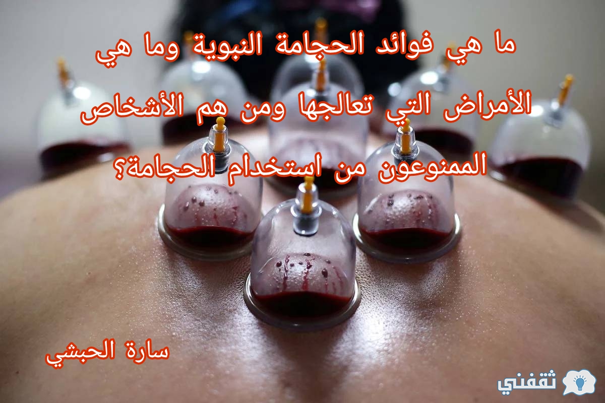 ما هي فوائد الحجامة النبوية وما هي الأمراض التي تعالجها ومن هم الأشخاص الممنوعون من استخدام الحجامة؟