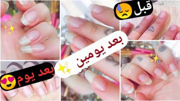 تطويل الأظافر وتبيضها وتقويتها في ٣ أيام فقط بمكونات لن تخطر على بالك