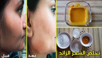 بالكركم تخلصي من شعر الوجه والجسم الزائد بالكامل بدون ألم نهائي وبمسحة واحدة