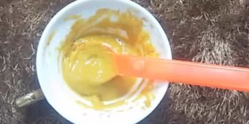 ازالة الشعر من الجسم الي الابد وبدون الم ولن ينمو مرة اخري بوصفات سريعة