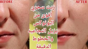 زيت الضرو لمكافحة التجاعيد