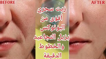 زيت الضرو لمكافحة التجاعيد هيمسح التجاعيد من وشك مسح