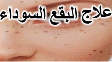 خلطة تفتيح الجسم وإزالة البقع