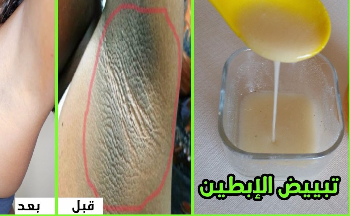  ‏كيف يتم تبييض الابط