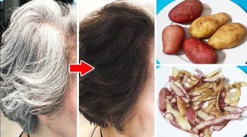 ‏فوائد قشور البطاطس وخصوصا في علاج شيب الشعر
